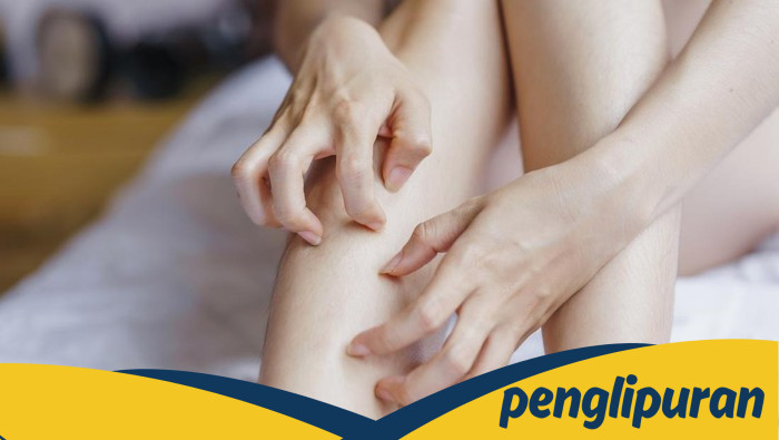 Gatal-gatal Nggak Sembuh? Mungkin Tanda Diabetes, Bukan Penyakit Kulit