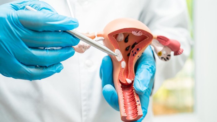 Kata POGI soal Viral Kasus 'Rahim Copot' Pasca Lahiran - Update 1