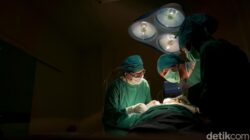 Rahim Copot, Dokter Ini Ungkap Kenyataan Mengerikan di Balik Viralitas Kasus Tragis Ini