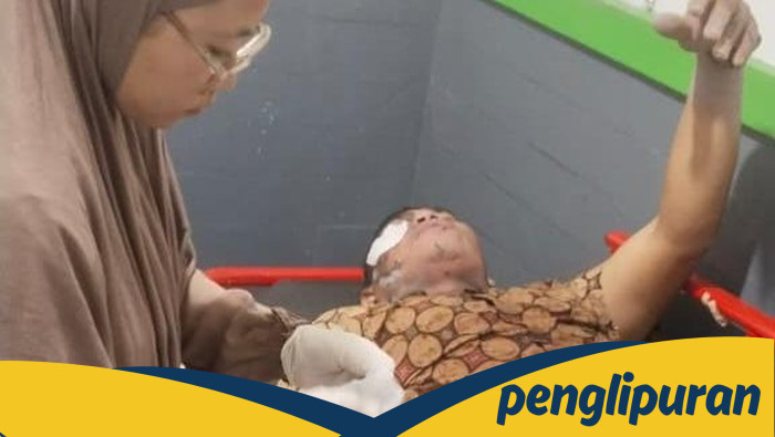 **Pasutri di Lumajang Terkena Awan Panas Erupsi Semeru, Luka Bakar 20%**