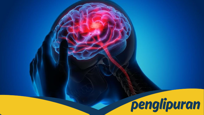 **Pengakuan Wanita yang 5 Kali Kena Stroke usai Pijat 'Kretek' dan Pentingnya Perhatian pada Gejala Stroke**