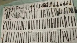 [Ngilu! Dokter Temukan 120 Benda Asing di Perut Pasien, Ada Pisau-Gunting]